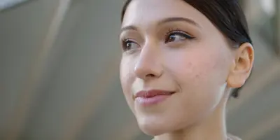Hoe verwijder je make-up van een acnegevoelige huid?